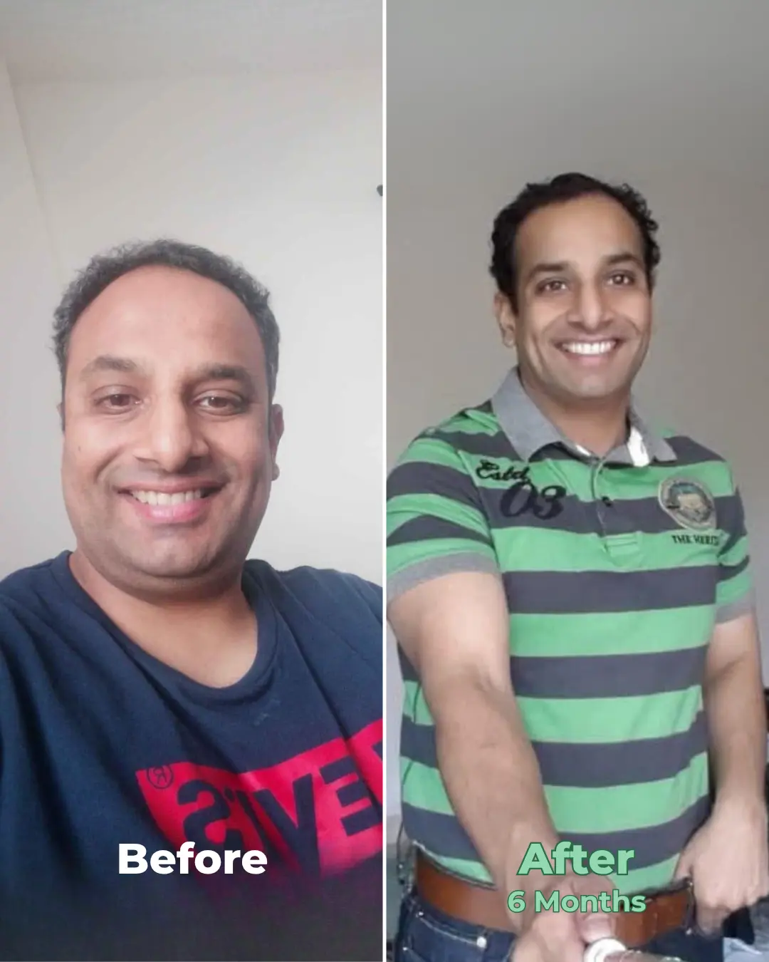 Nadir Malik Before and After